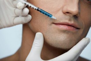 Men and women can receive dermal fillers, but the injection technique differs to accommodate the facial anatomy of males. 
